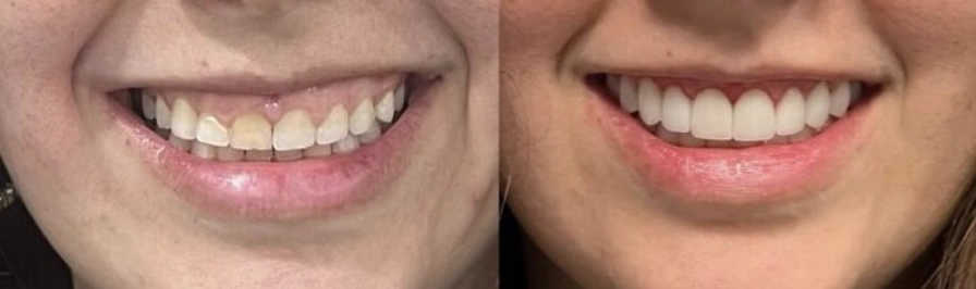 Green Pond Dental Associates