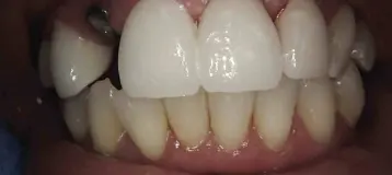 Smile Dental of New Rochelle