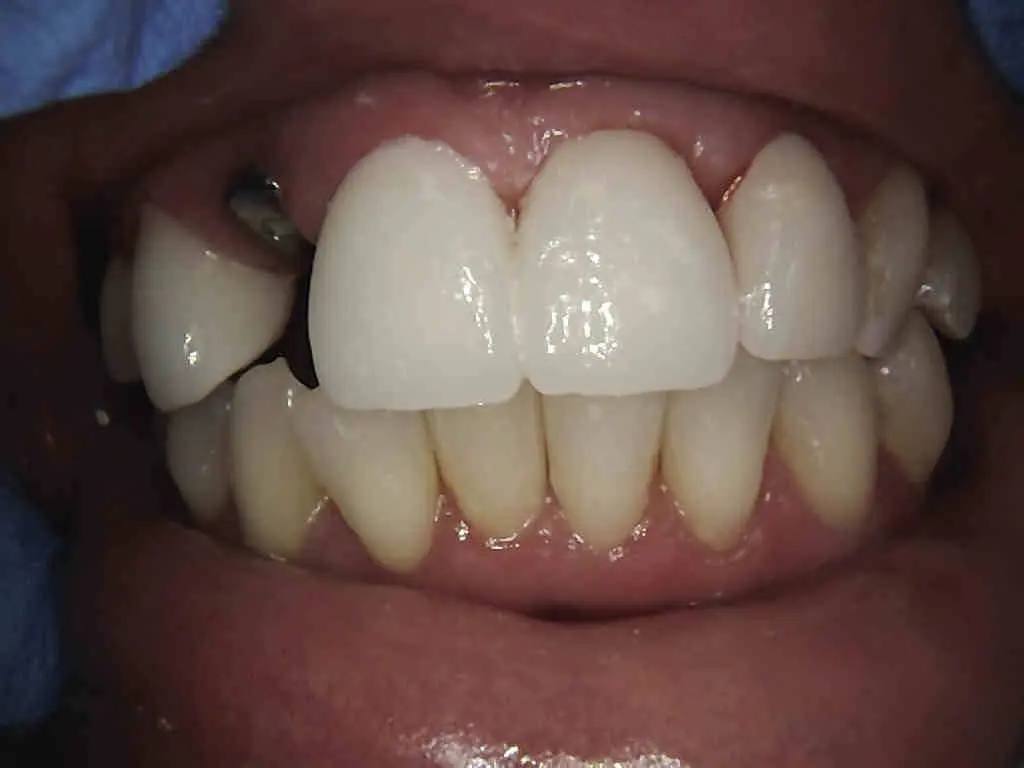 Smile Dental of New Rochelle - Professional dental clinic exterior with modern facilities