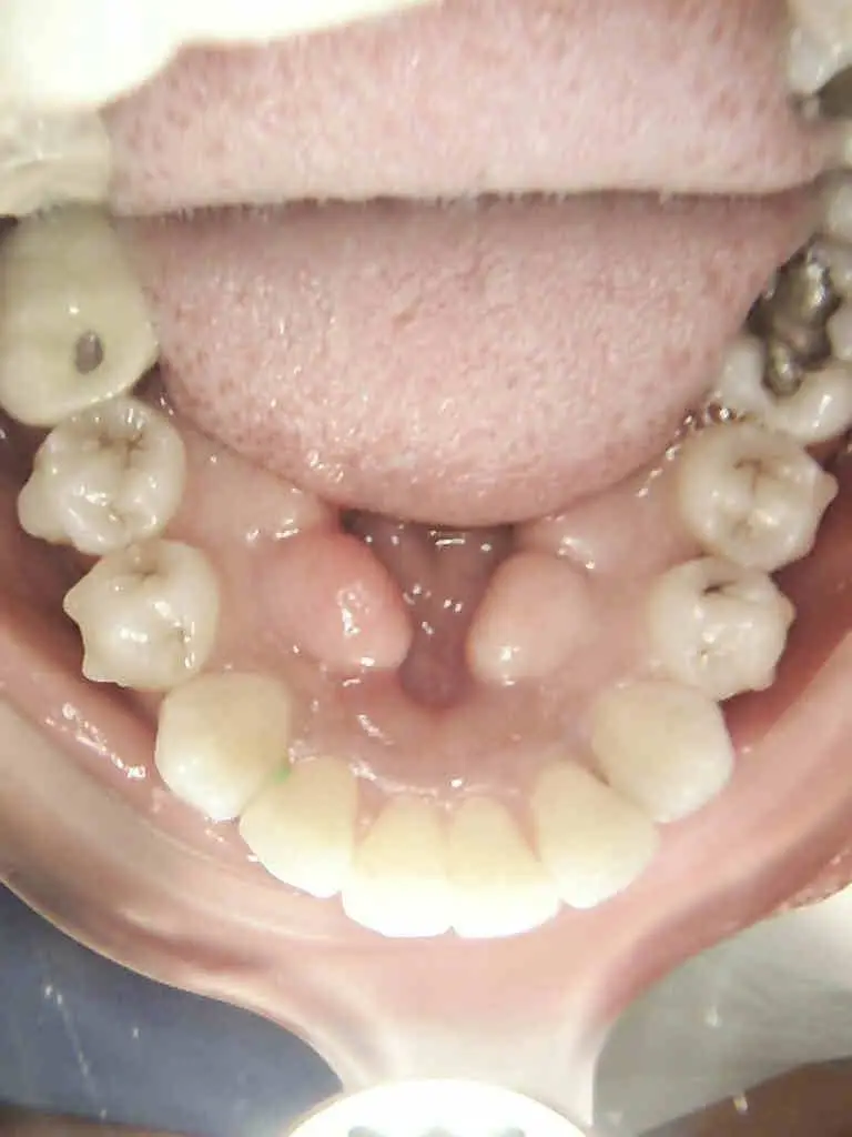 Smile Dental of New Rochelle