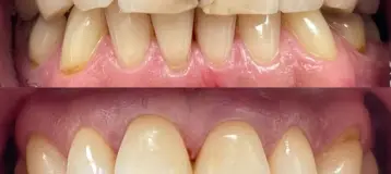 White Plains Dental