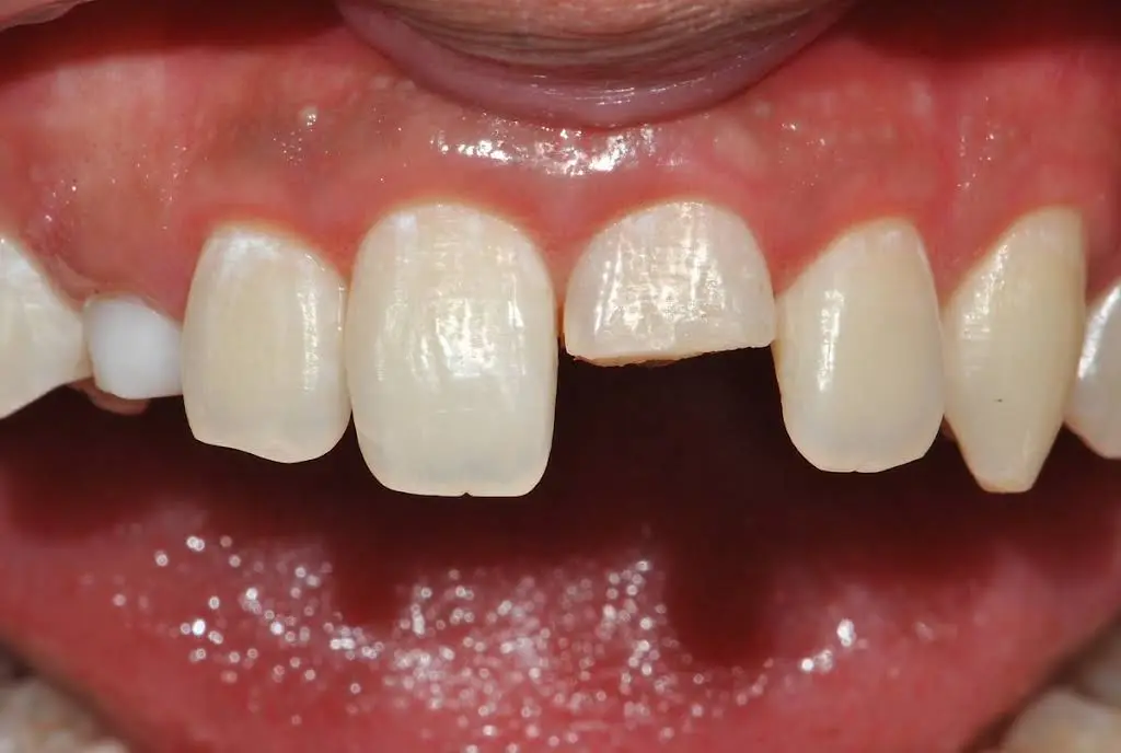 All County Endodontics