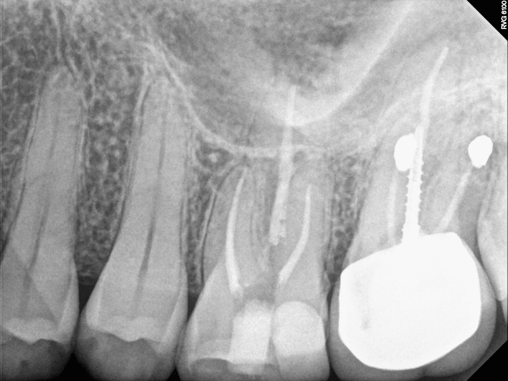 All County Endodontics