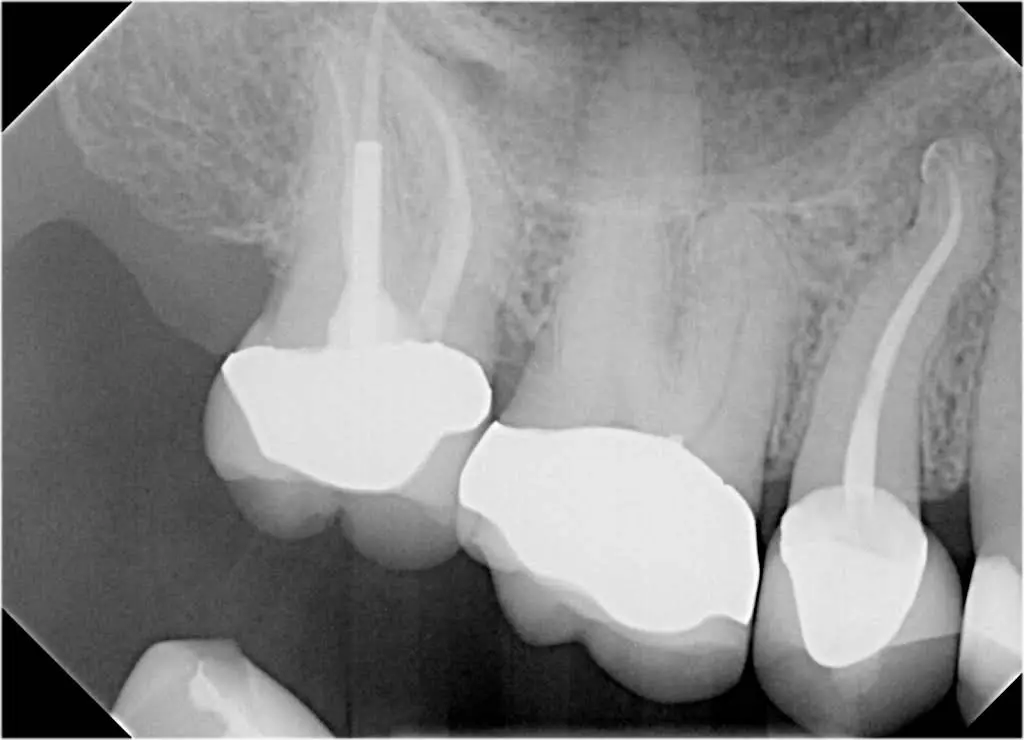 All County Endodontics