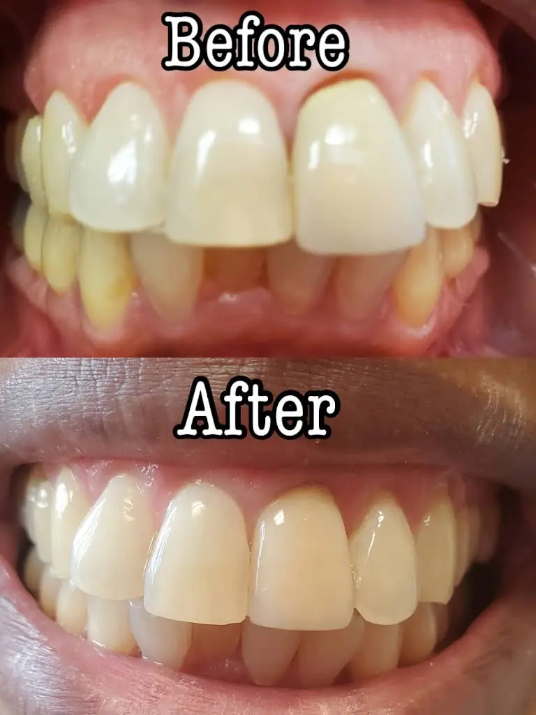 Lake Dental