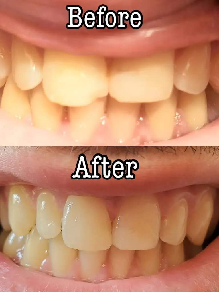 Lake Dental