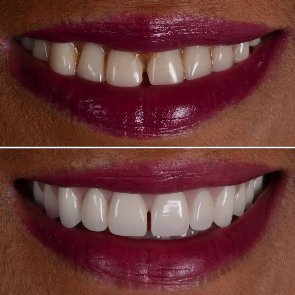 Elim Dental