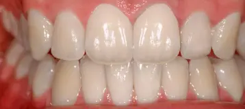 Center for Dental Excellence: Edward J Prus DDS