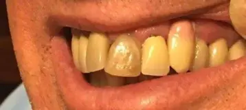 NorthStar Implant Dentistry