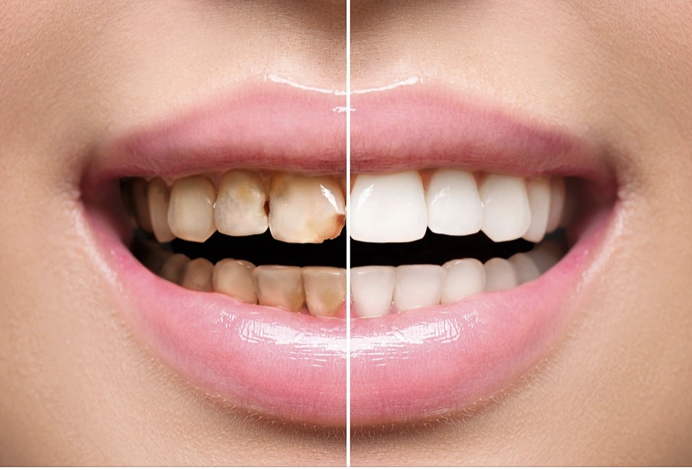 Westchester Dental Care - Professional dental clinic exterior with modern facilities