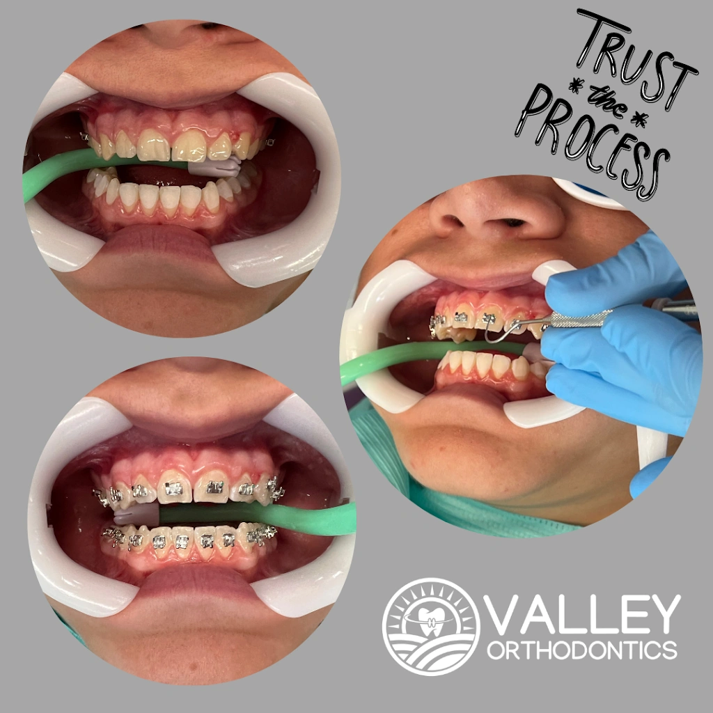Valley Orthodontics - Dr. Tamara Kroboth
