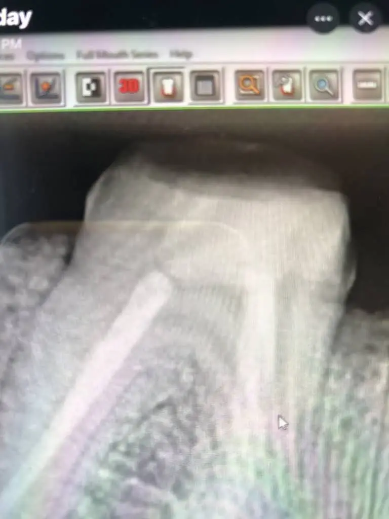 Endodontics of The Hudson Valley