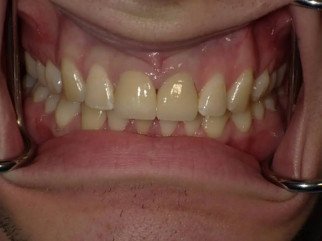 Blossom Dental
