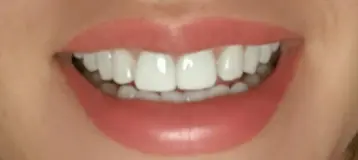 Doyle Dental