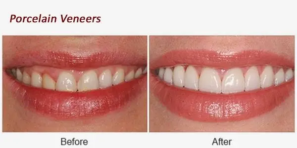 Gentle Dental - Commack