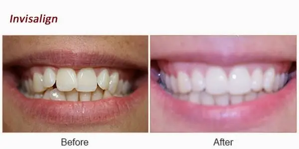Gentle Dental - Commack