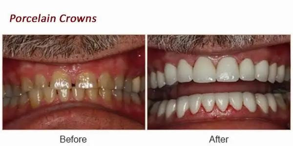 Gentle Dental - Commack