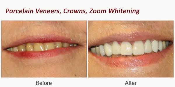 Gentle Dental - Commack