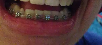 Dr. Azin Pediatric Dentistry