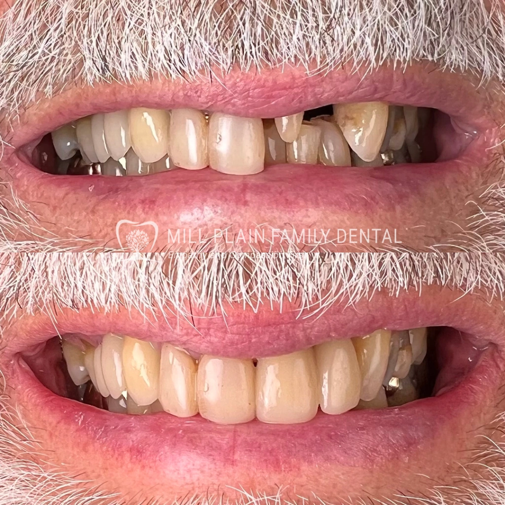 Mill Plain Family Dental