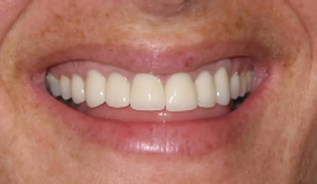 East Northport Dental Care - Professional dental clinic exterior with modern facilities