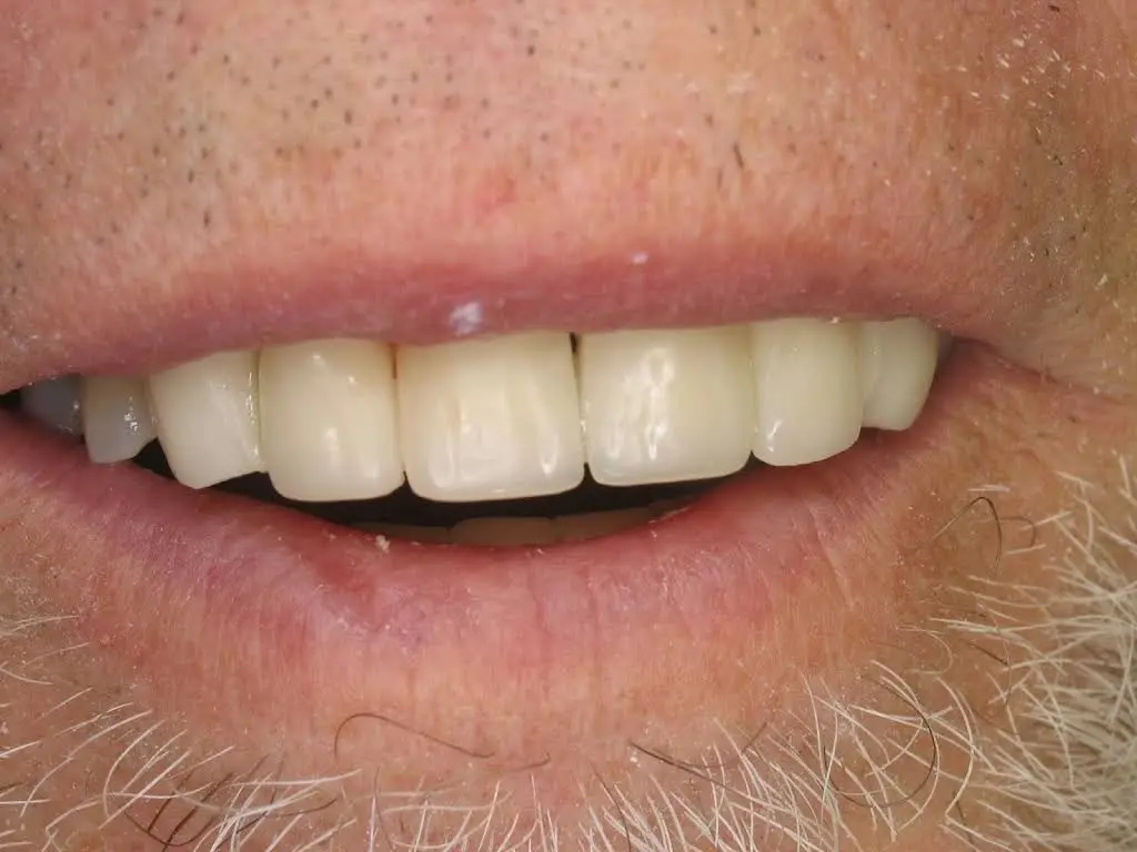 East Northport Dental Care
