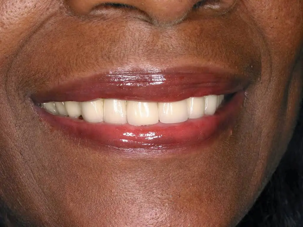 East Northport Dental Care