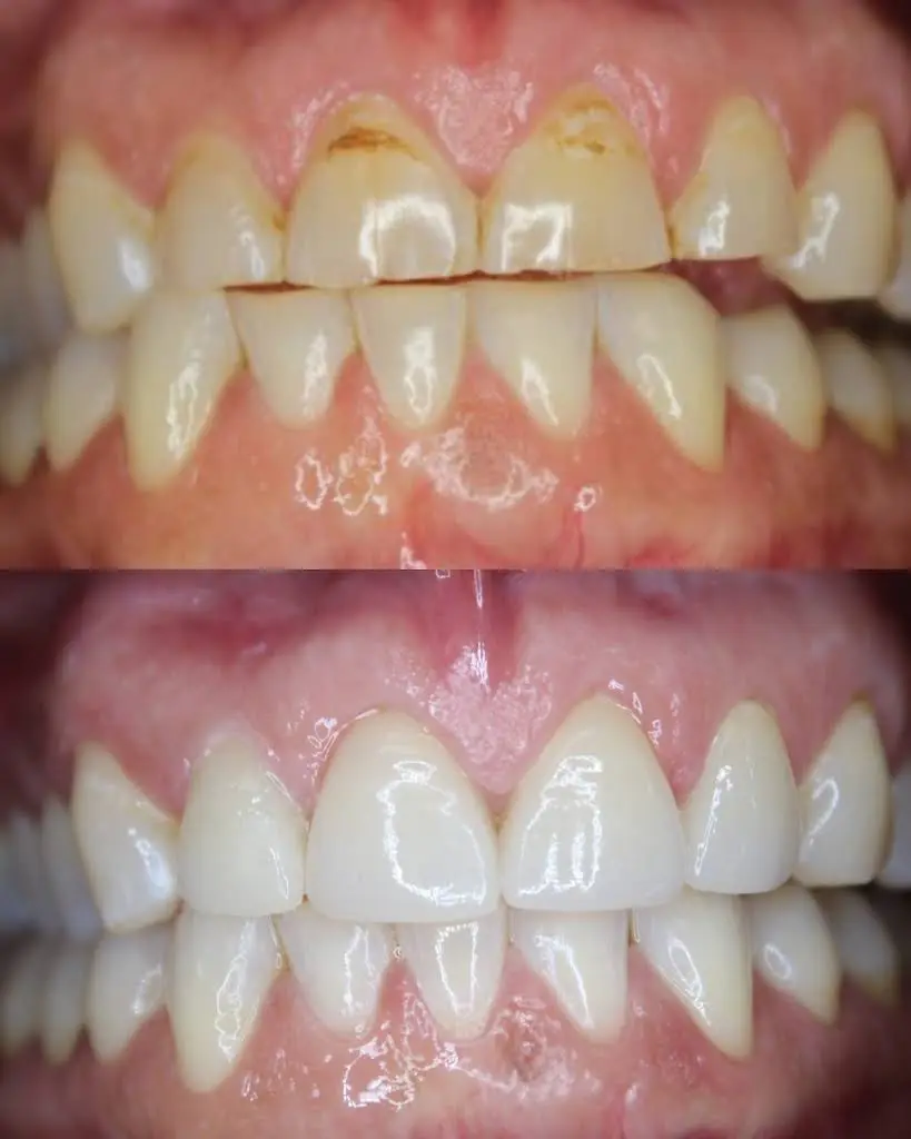 Carlone Family Dental