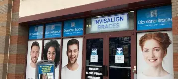Diamond Braces