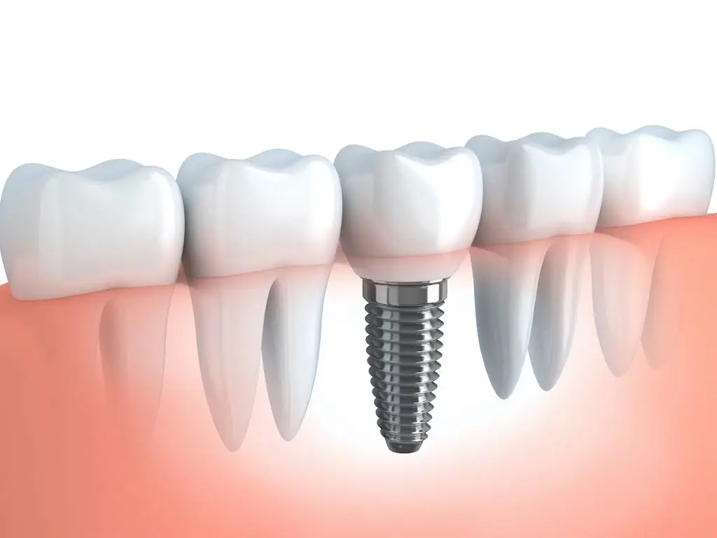 All About You Dental Group