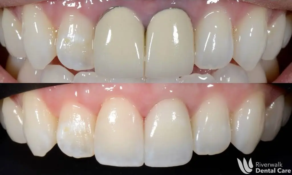 Riverwalk Dental Care