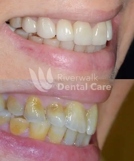 Riverwalk Dental Care