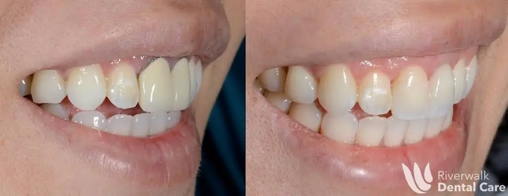 Riverwalk Dental Care