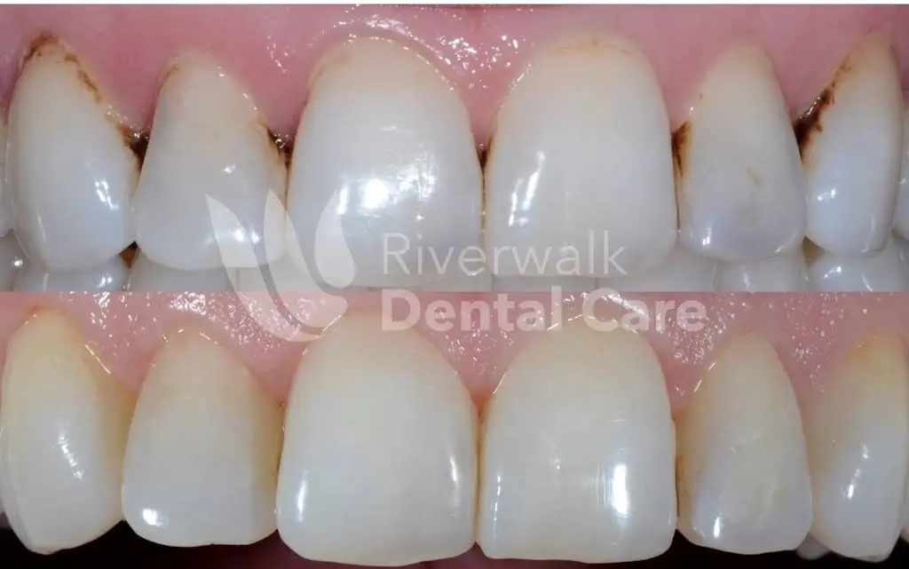 Riverwalk Dental Care