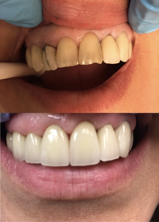 Commack Family Dental