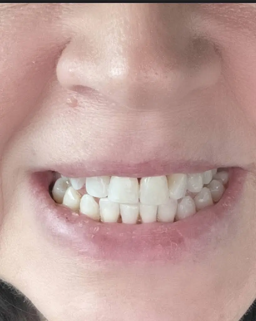 The Center for Cosmetic Dentistry