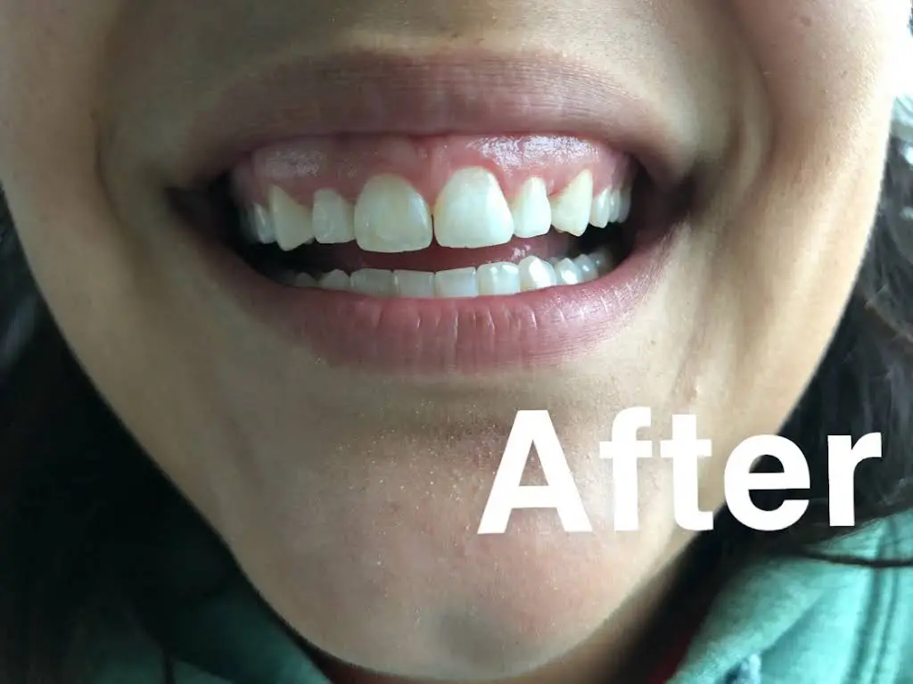 The Center for Cosmetic Dentistry
