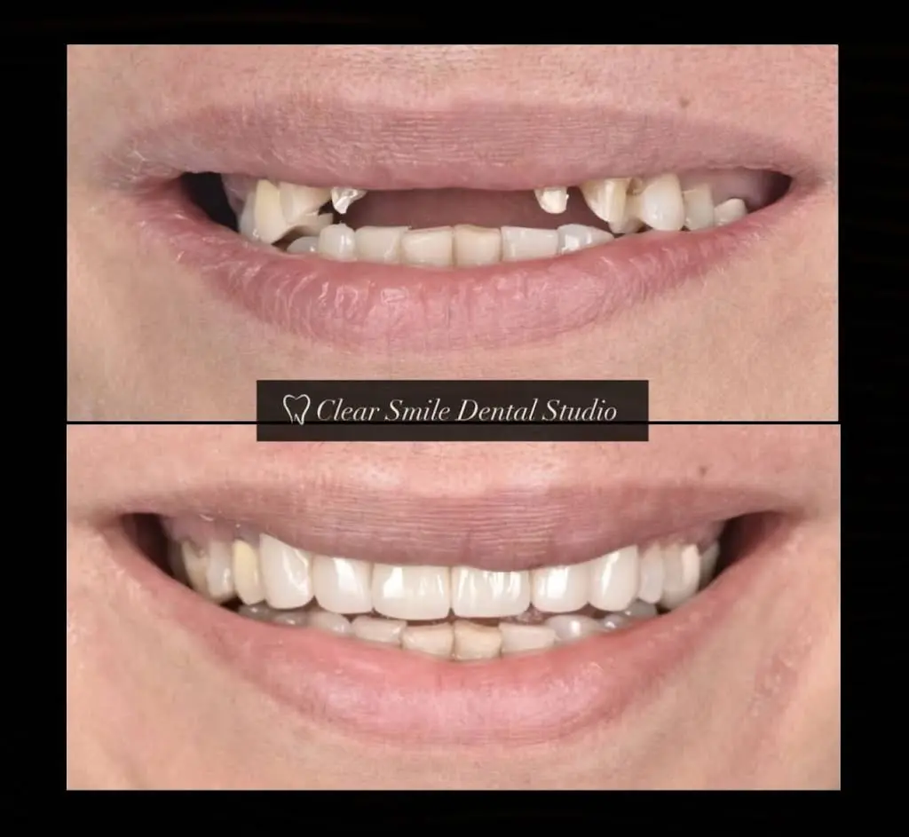 Clear Smile Dental Studio