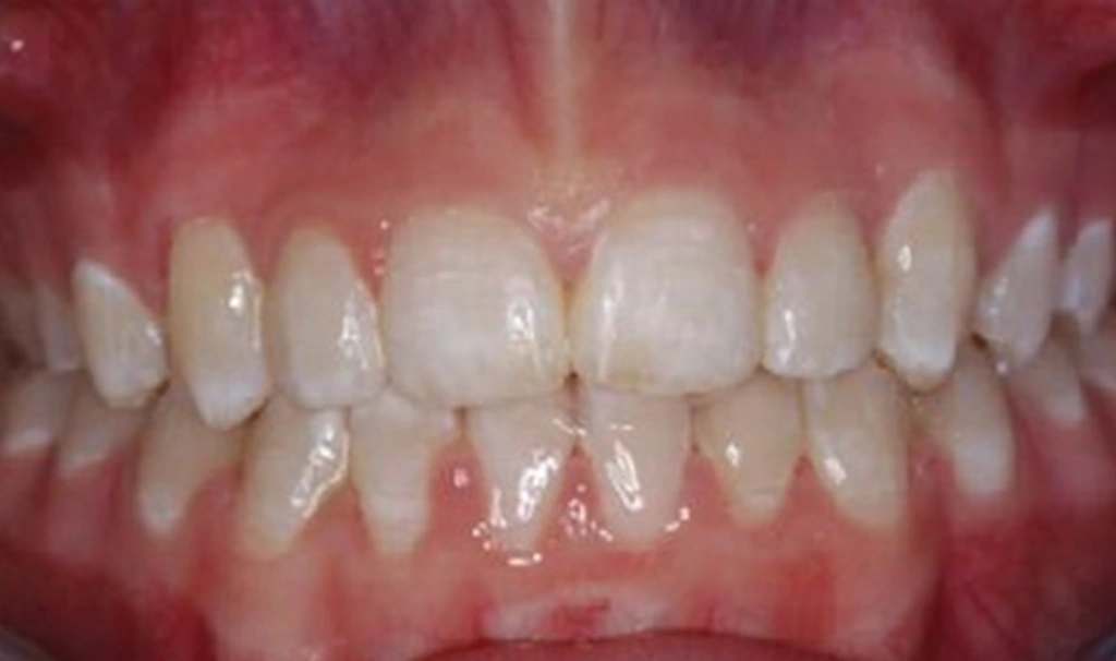 Precision Dental Care