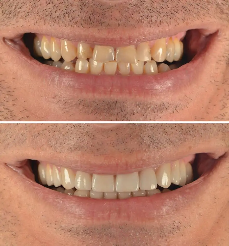 Aesthetic Dentistry of Fairfield