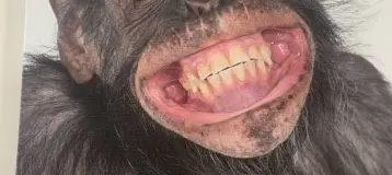 Bristol Oral Surgery & Implant Center