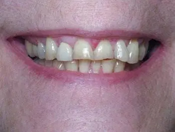 Fontana Family Dental Care