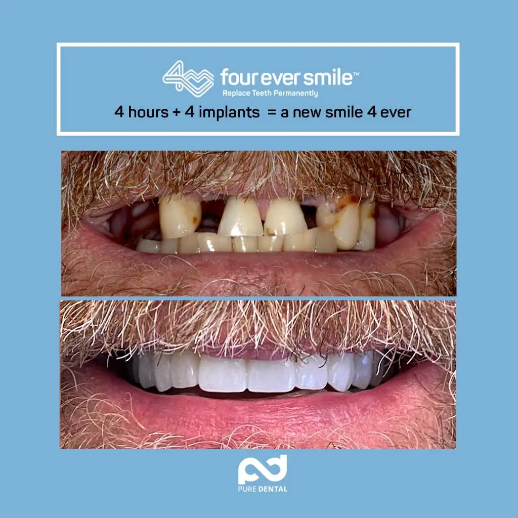 Pure Dental - Wading River