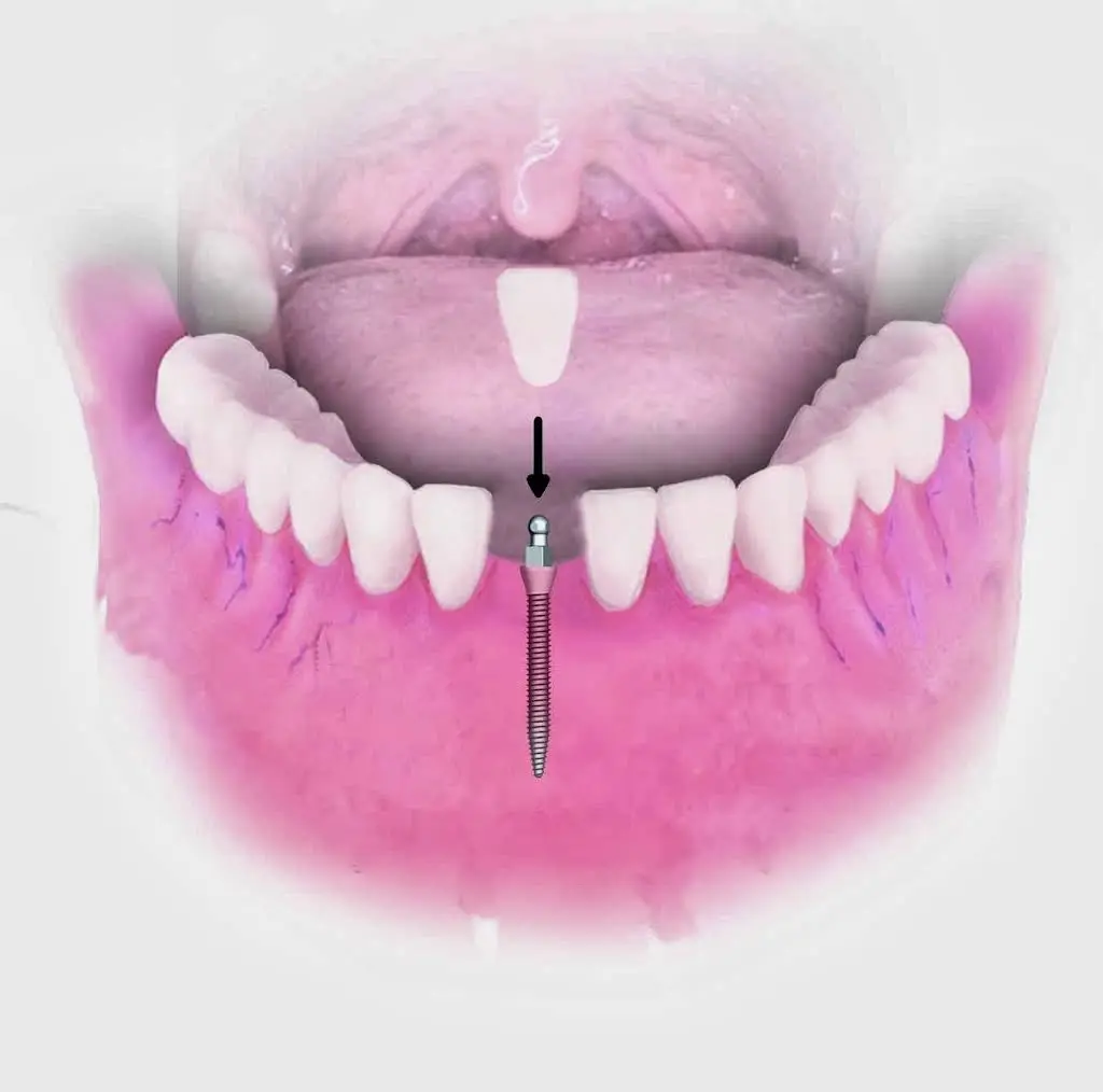 Keep Smiling Hartford Dental Implant Center - Professional dental clinic exterior with modern facilities