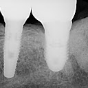 Dr. William Lee Willis, DDS